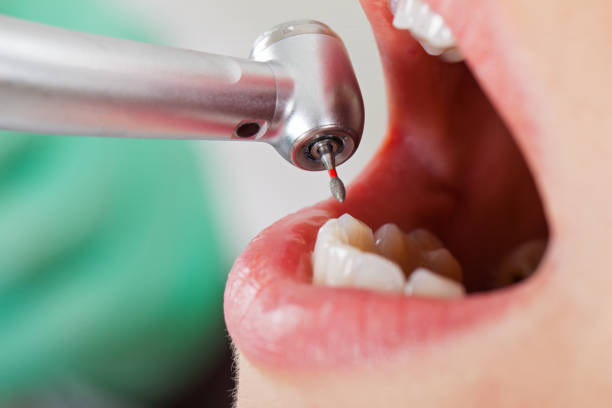 Best Dental Abscess Treatment in Folkston, GA